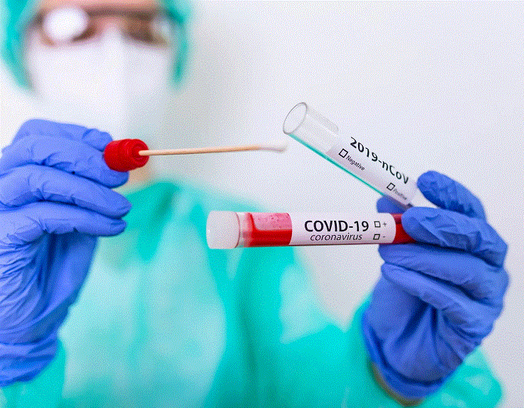 Coronavirus, in crescita i contagi: 471 oggi in Campania su 8.811 tamponi molecolari. 2 deceduti