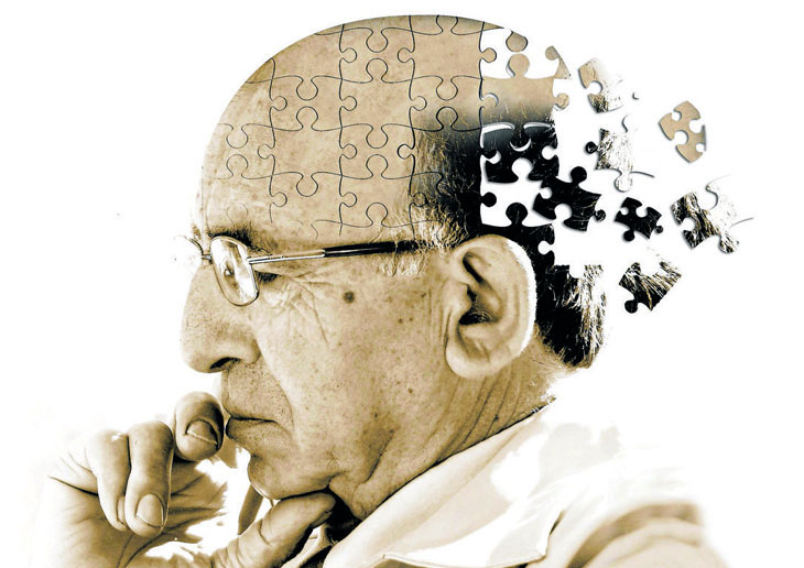 La FDA approva il primo farmaco per rallentare la progressione dell'Alzheimer.